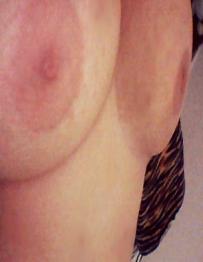 photo-thumb