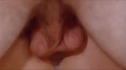 Thumb 1