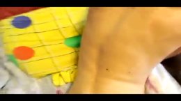 Thumb 15