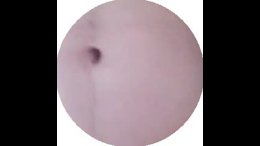 Thumb 9
