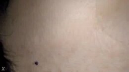 Thumb 14